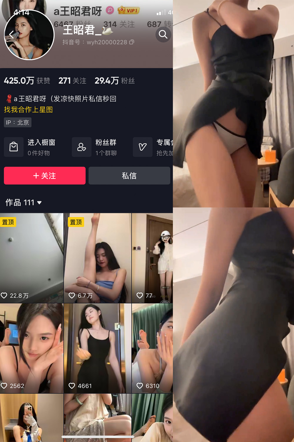 抖音 王昭君 微密圈 NO.010期