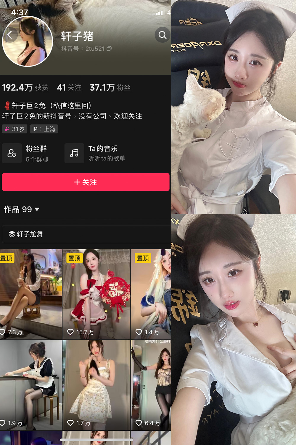 抖音 轩子巨二兔 微密圈 NO.023期