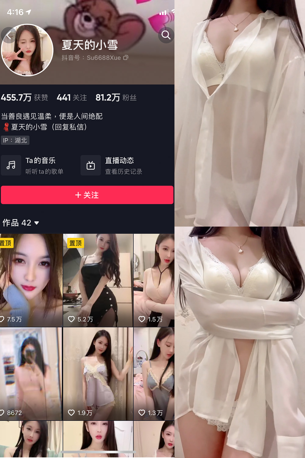 抖音 夏天的小雪 微密圈 嘉宾专享 NO.011期