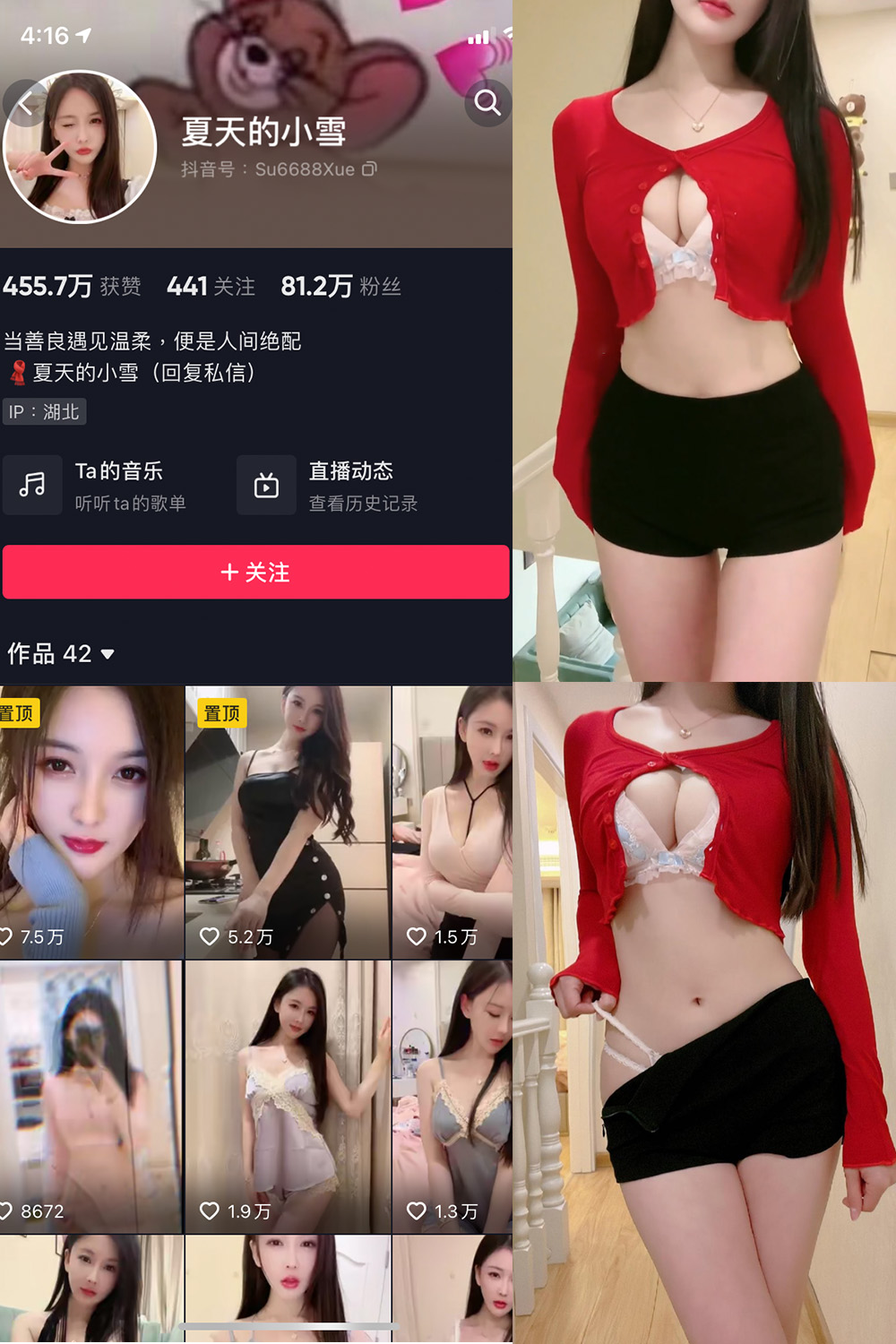 抖音 夏天的小雪 微密圈 NO.006期