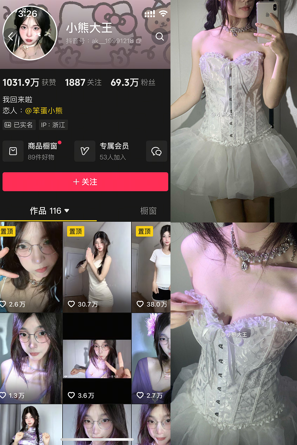 抖音 小熊大王 微密圈 001期