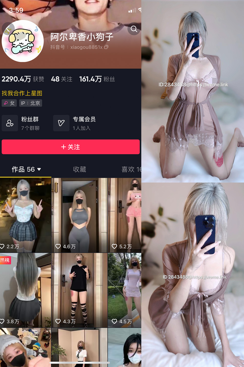 抖音 阿尔卑香小狗子 微密圈 NO.045期