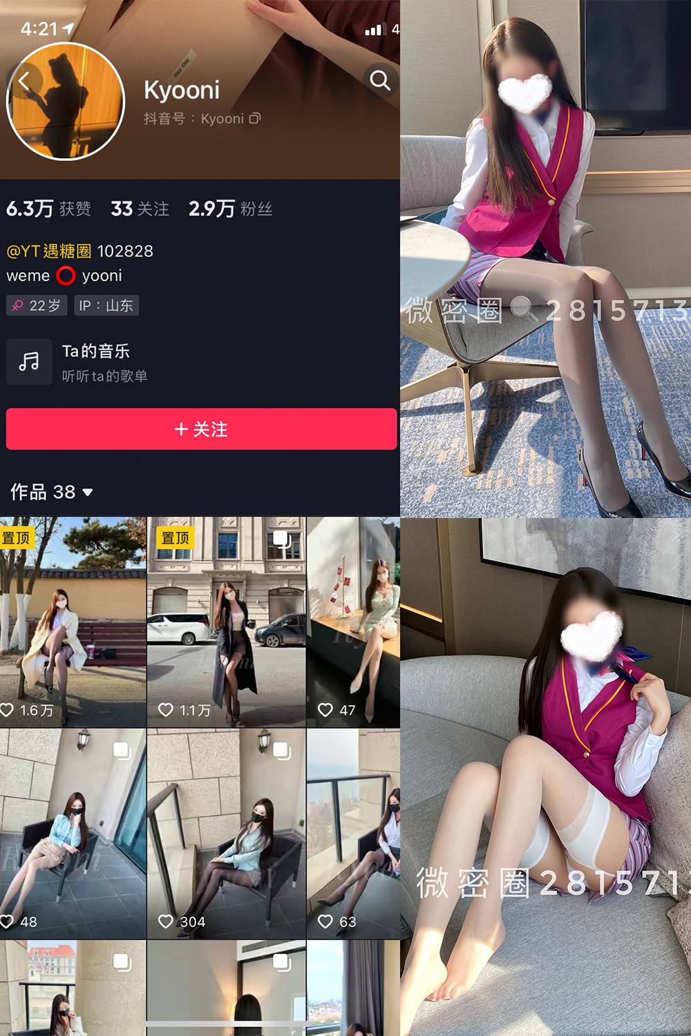 抖音 Yooni有你喵 微密圈 NO.004期