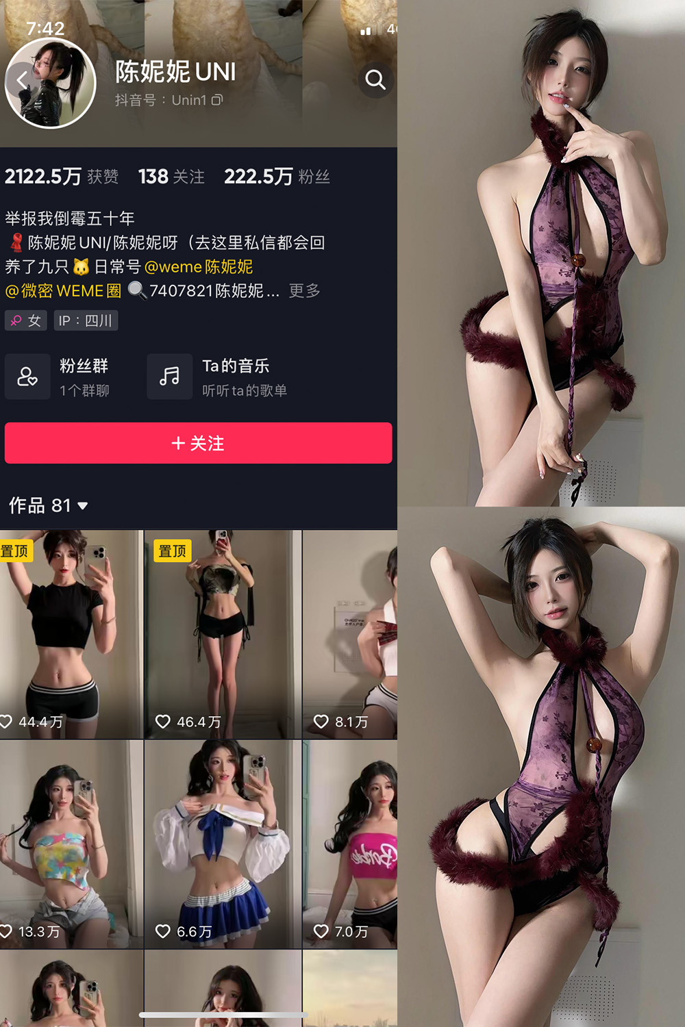 抖音 陈妮腻UNI 微密圈 NO.075期